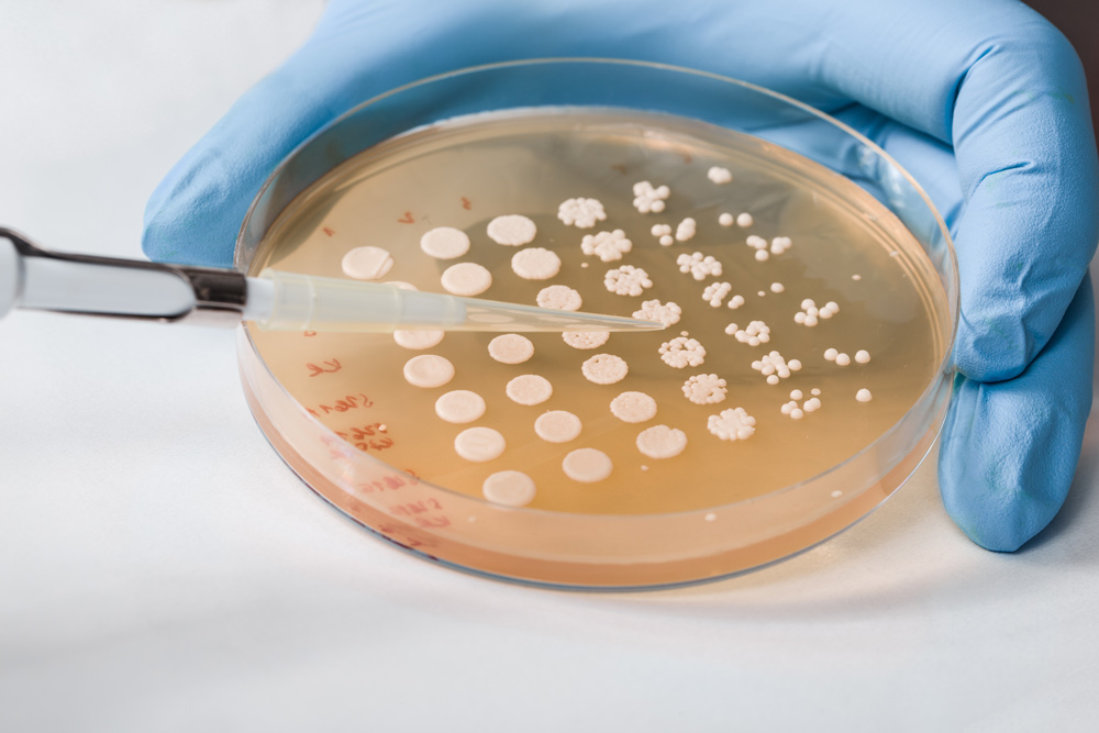 cultivo de levadura en placa de Petri